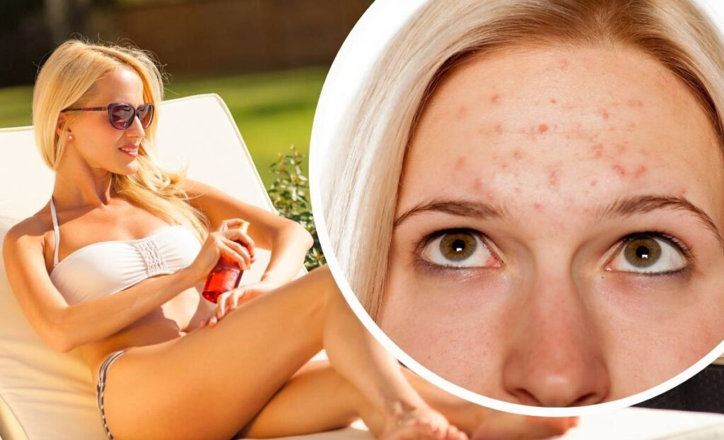 causes of dark spots on skin