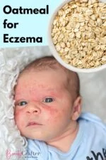 Oatmeal for Eczema with baby with eczema rash on face.