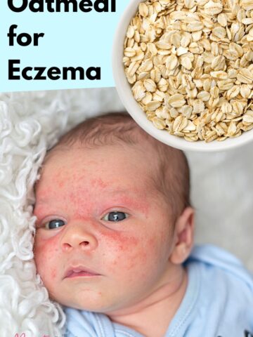 Oatmeal for Eczema | A Simple Natural Remedy