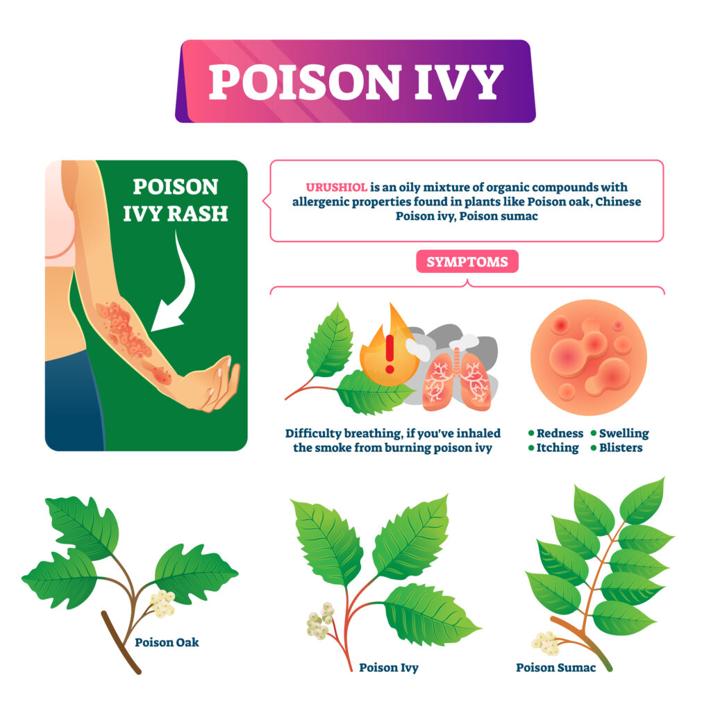 Poison ivy  symptoms and description. Leaves of the poison ivy plant compared with poison oak and poison sumac.