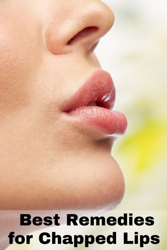 best natural remedies for chapped lips