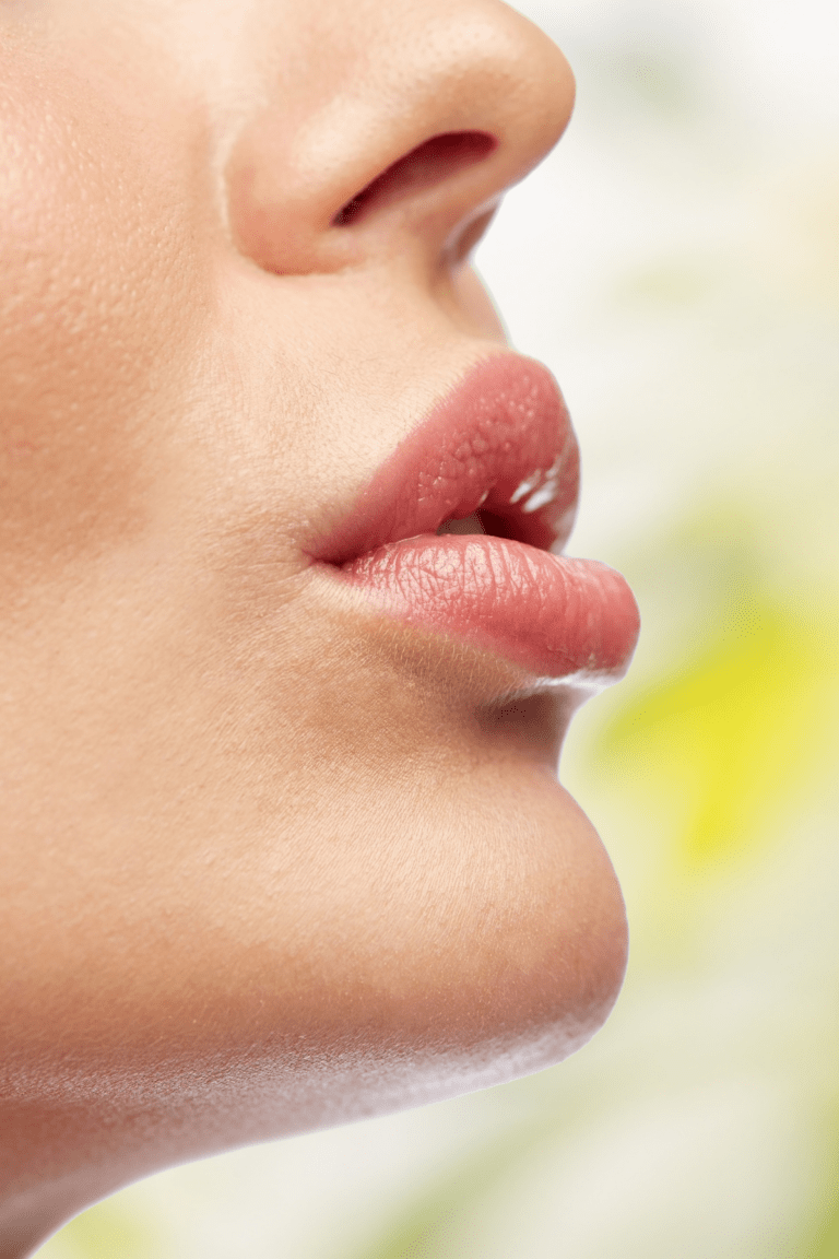 remedies for chapped lips, woman with healthy lips