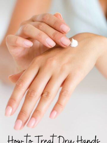 Dry Hands - 10 Best Ways to Treat Dry Skin on Hands