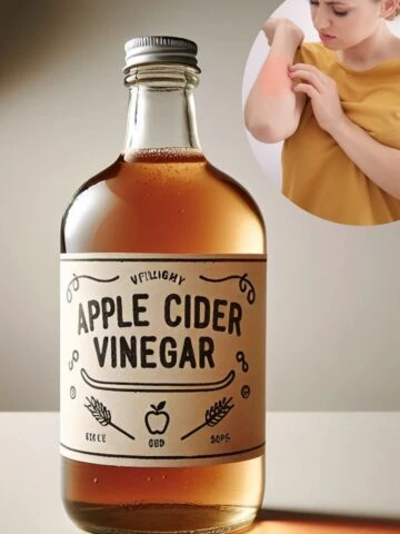 apple Cider Vinegar for skin rashes